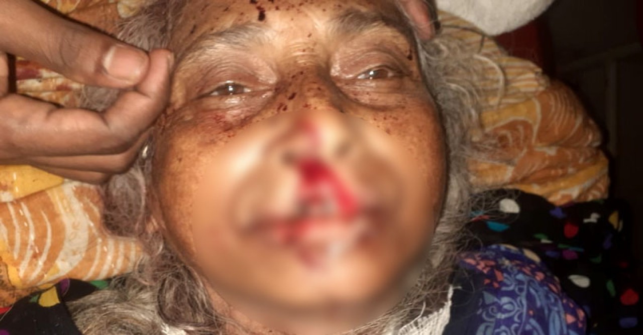 ভোর রাতে ঘরে ঢুকে স্ত্রী,কন্যা ও শাশুড়িকে কুপিয়ে জখম