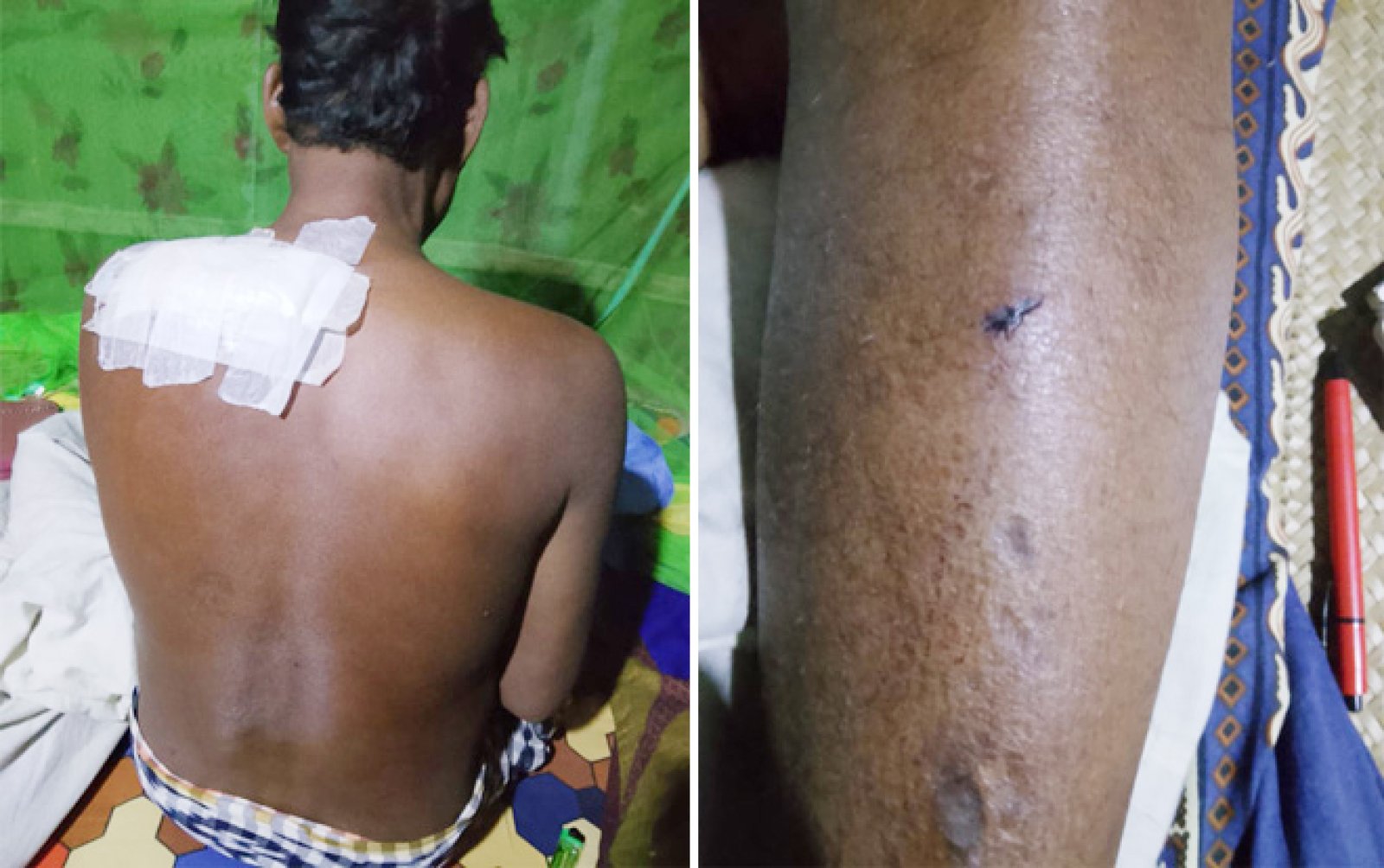গোদাগাড়ীতে মাছ ব্যবসায়ীকে কুপিয়ে নগদ টাকা ও মোবাইল ছিনতাই