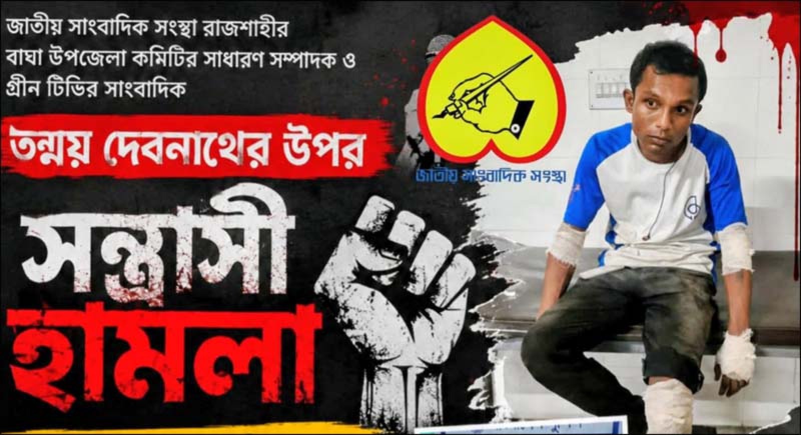 রাজশাহীতে সাংবাদিক তন্ময় দেবনাথের ওপর সন্ত্রাসী হামলা