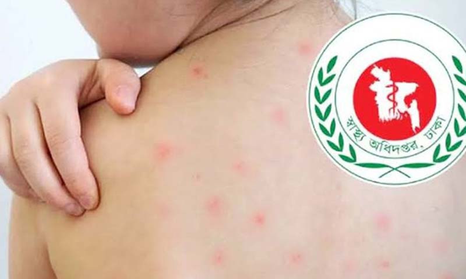 হামে মৃত্যু হাজার ছুঁইছুঁই