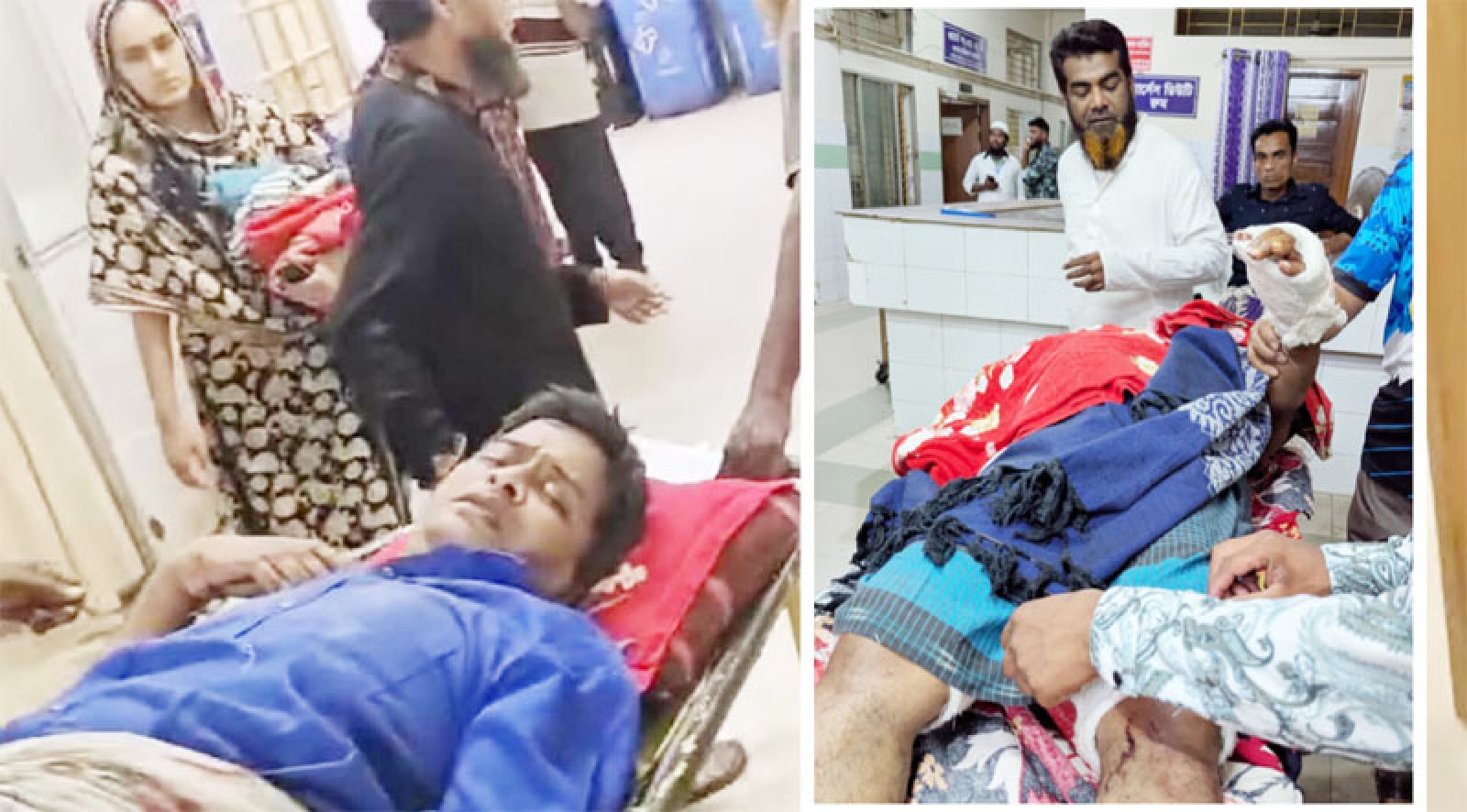 চুরি মামলা তুলে না নেয়ায় সাংবাদিককে কুপিয়ে জখম-আঙুল বিচ্ছিন্ন