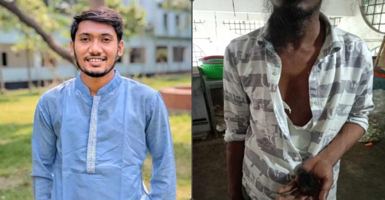 ‘বাকির টাকা’ চাওয়ায় দাড়ি ছিঁড়ে ফেললেন ছাত্রলীগ নেতা