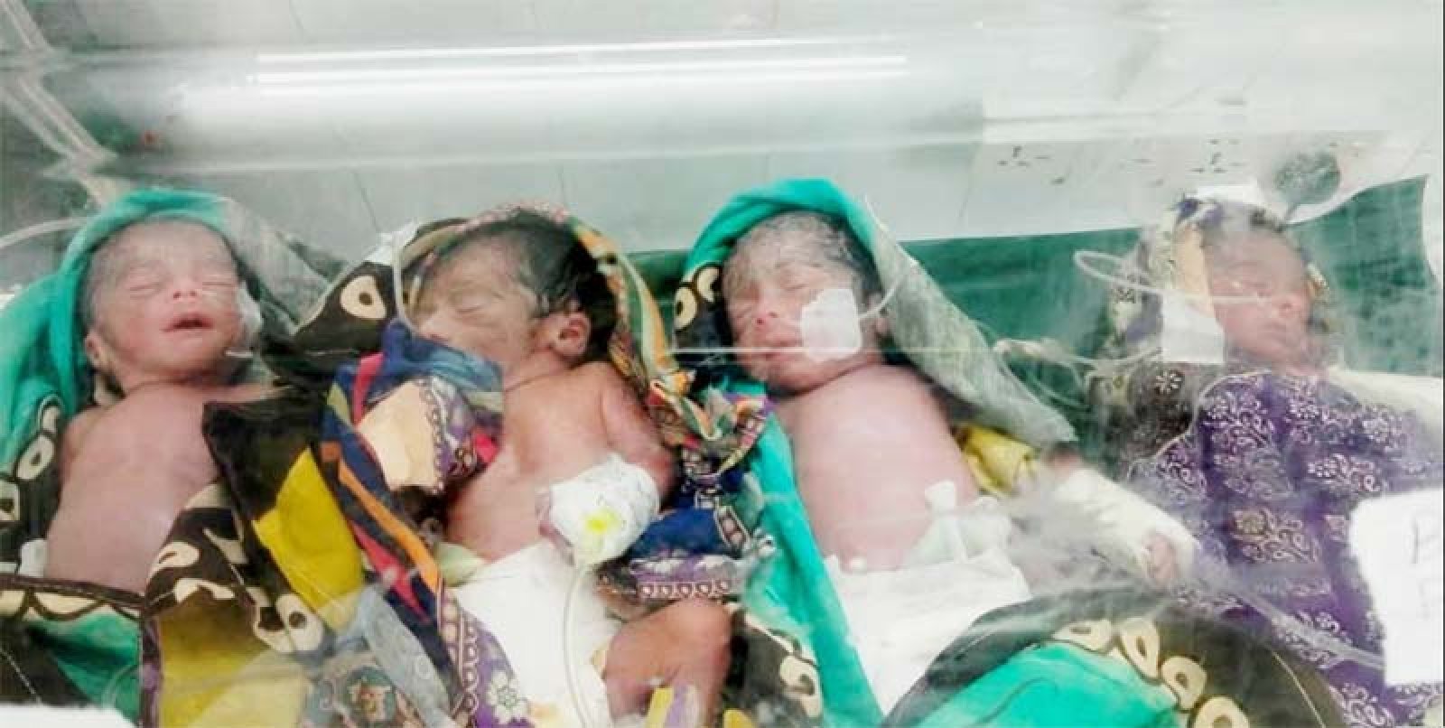 রাজশাহীতে একসঙ্গে চার সন্তানের জন্ম॥ মা ও নবজাতকরা সুস্থ