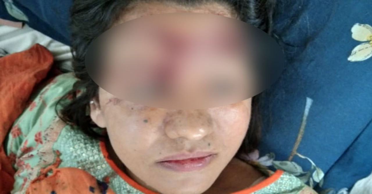ফিল্মি স্টাইলে মামলার বাদীর পথরোধ করে মারধর॥ হাসপাতালের বেডে আর্তনাদ আহত লাভলীর