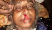 ভোর রাতে ঘরে ঢুকে স্ত্রী,কন্যা ও শাশুড়িকে কুপিয়ে জখম