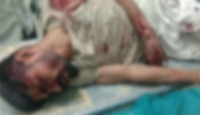 তাঁতী দল নেতাকে কুপিয়ে আহত