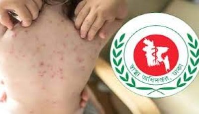 হাম ও হামের উপসর্গে ২৪ ঘণ্টায়  আরও ৭ শিশুর মৃত্যু