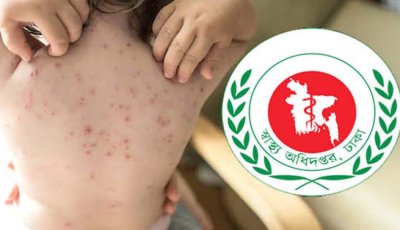 হাম ও হামের উপসর্গ নিয়ে আরও ৭ শিশুর মৃত্যু