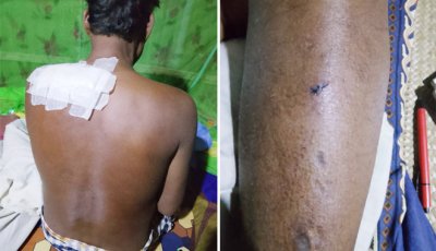 গোদাগাড়ীতে মাছ ব্যবসায়ীকে কুপিয়ে নগদ টাকা ও মোবাইল ছিনতাই