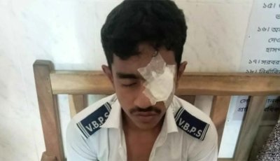 খাতা দেখতে না দেওয়ায় সহপাঠীকে ঘুষি মেরে আহত করল এসএসসি পরীক্ষার্থী