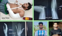 ইভটিজিংয়ের প্রতিবাদ করায় শিক্ষকের দুই হাত ভেঙ্গে দিল কিশোর গ্যাং