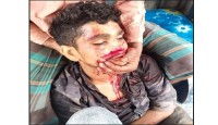 মহিষকে পানি খাওয়াতে যাওয়ার পথে কিশোরের মৃত্যু