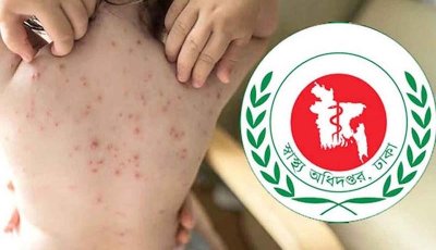 হামের উপসর্গ নিয়ে আরও আট শিশুর মৃত্যু